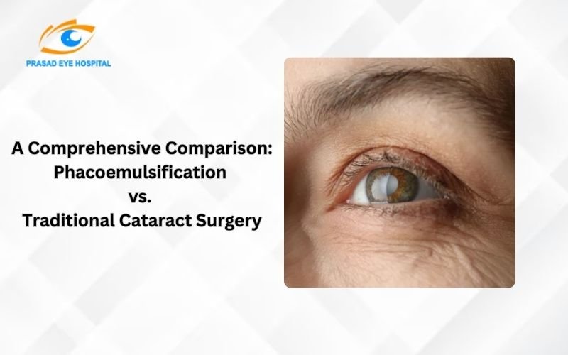 Phacoemulsification vs. Traditional Cataract Surgery