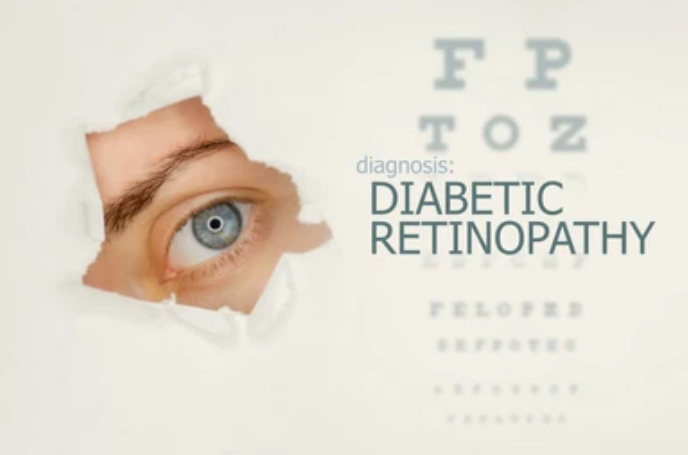 Diabetic Retinopathy Treatment: