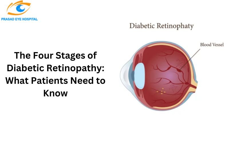 Diabetic Retinopathy