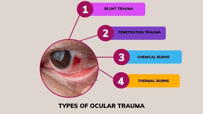 Types of Ocular Trauma