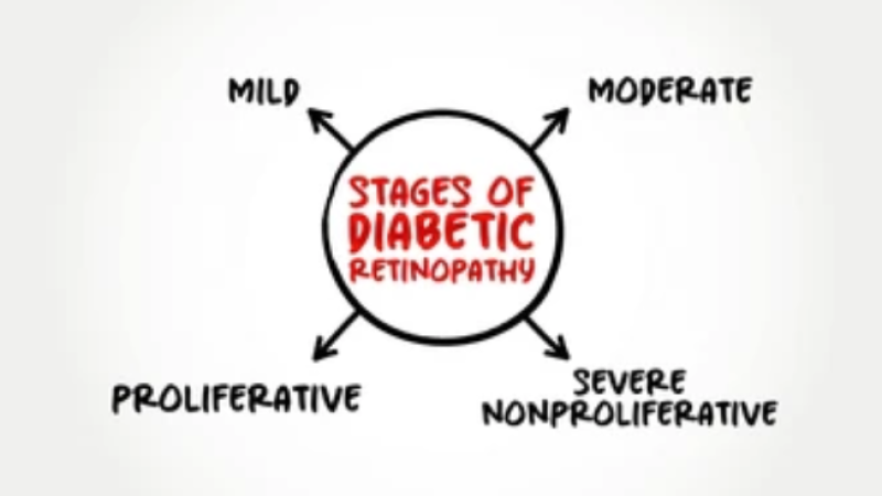 Diabetic Retinopathy Treatment